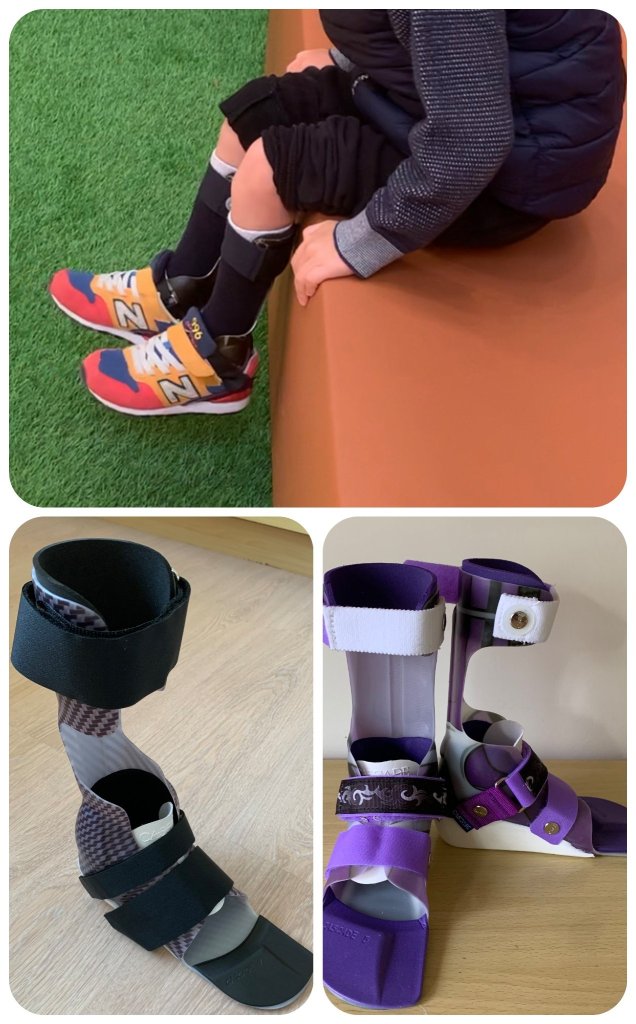 Exemples de DAFO réalisées pour nos patients 